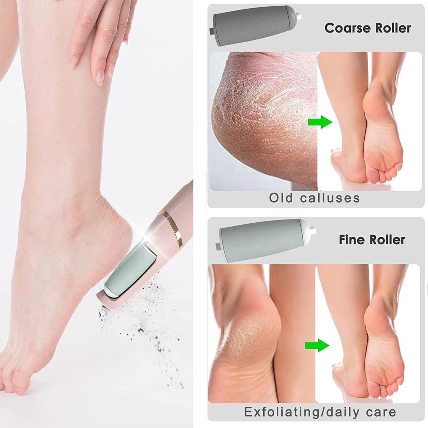 Electric Pedicure Foot File Callus Remover – Smooth & Soft Feet Care Tool