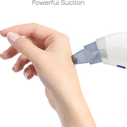 Blackhead Remover Pore Vacuum for face